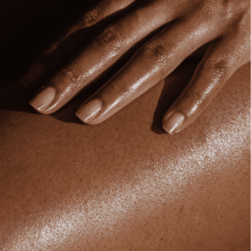 5-Fluorouracil & Triamcinolone Therapy