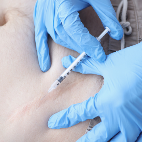 Keloid and Hypertrophic Scar Treatment