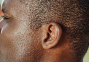 KELOID EAR RISKS