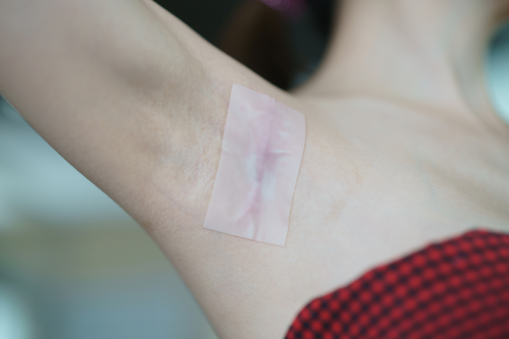 Natural & Holistic Support for Keloid Recovery