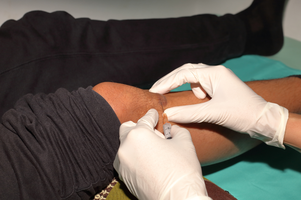 Complete Guide to Keloid Prevention