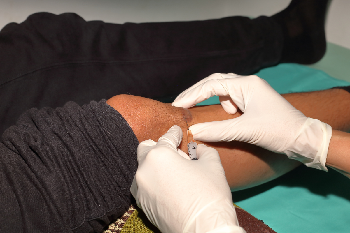 Combination Therapy Protocols: Maximizing Keloid Treatment Success in 2025