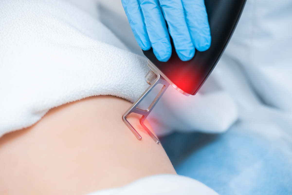 Research Collaboration: How London Keloid Scar Clinic Advances the Field